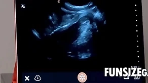 Ultra sensible probingly compare arrive - dr wolf, austin