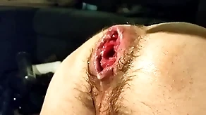 Just fisting my bad crevice together with prolapse:)