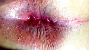 Irritant increased by anus closeup
